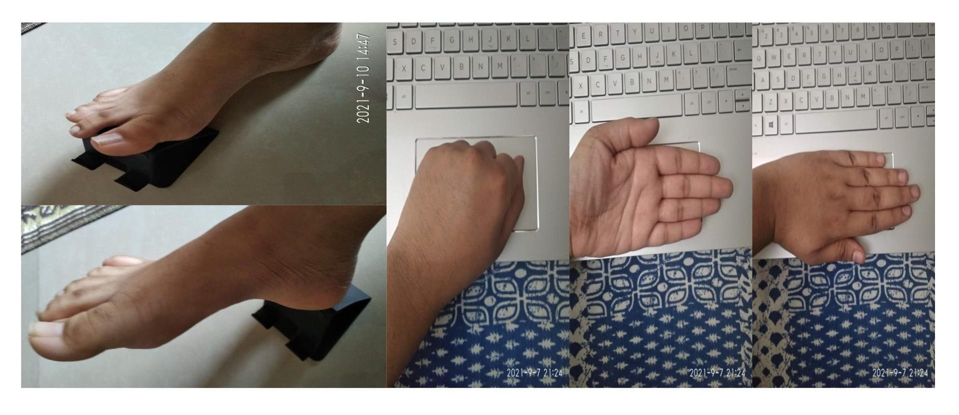 A set of photos showcasing different interactions with assistive devices: on the left, a foot interacting with a foot pedal or switch, and on the right, a series of hand gestures interacting with a laptop touchpad, showing a closed fist, an open palm, and various positions in between. The images are timestamped and appear to document a testing process.